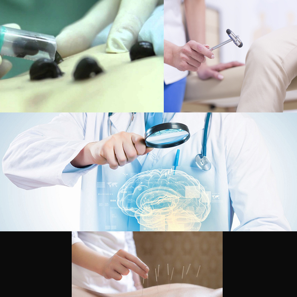 Иглотерапия, пиявки, невпапотолог НЕЙРО-МЕД - Изображение #1, Объявление #1666653